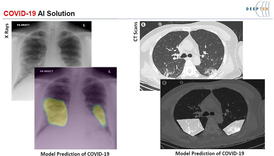 図1：COVID-19の医療画像AI診断画面サンプル