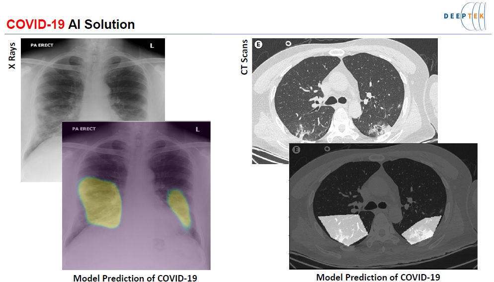 Fig. 1: Samples of COVID-19 AI-based diagnostic images