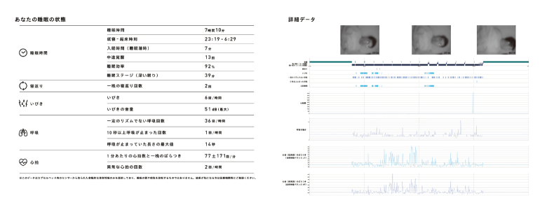 宿泊者のおみやげは「睡眠データ」 | DATA INSIGHT | NTTデータ - NTT DATA